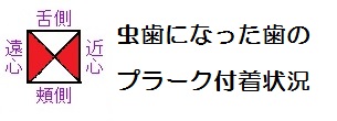 新潟市＿歯のクリーニング＿プラークチャートｓｋ.jpg