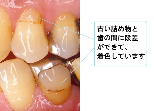 niigata_whitening_repair6.jpg