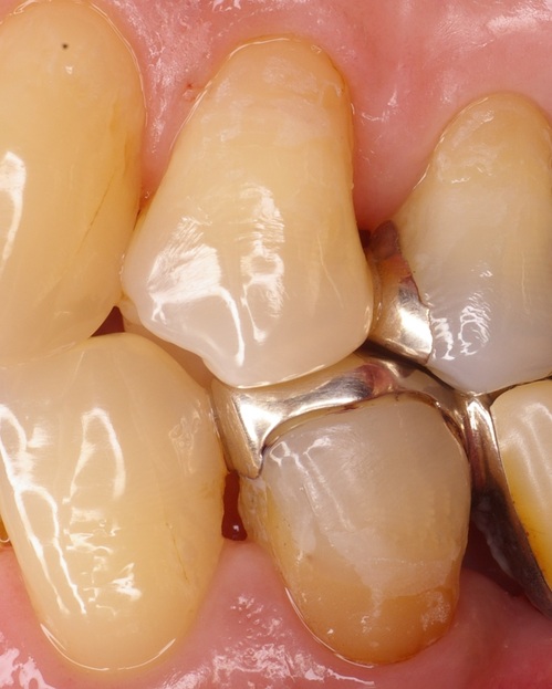 niigata_whitening_repair7.jpg