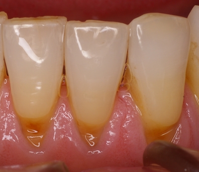 niigata_whitening_wsd1.jpg