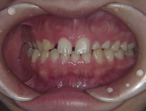 niigata_whitening_ok1.jpg