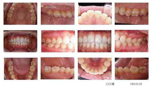 niigata_whitening_photogoods.jpg