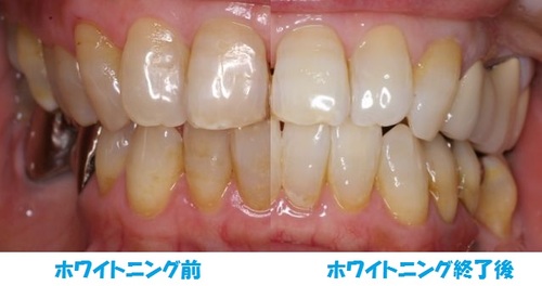 niigata_whitening_NK1.jpg