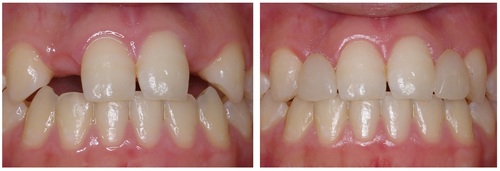 niigata_whitening_ayngtcase.jpg