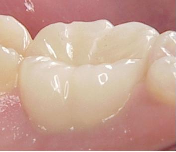 niigata_whitening_nerve2.jpg