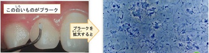 dental_hygenist23.jpg