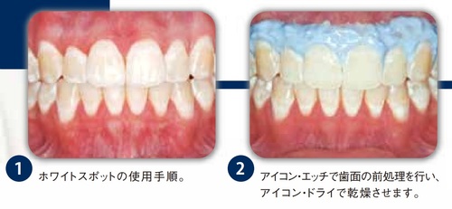 Whitespot1.jpgのサムネール画像