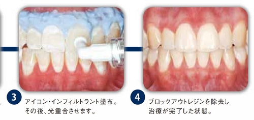 Whitespot2.jpgのサムネール画像