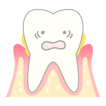 periodontosis_mechanism03.pngのサムネール画像