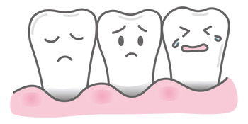 gingiva1.jpgのサムネール画像