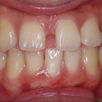 case03_1.jpg