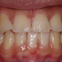 case03_2.jpg